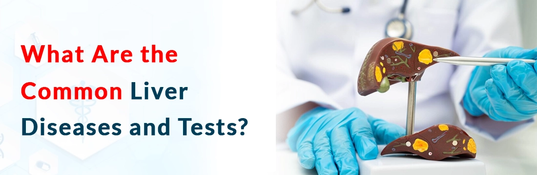  What Are the Common Liver Diseases and Tests?